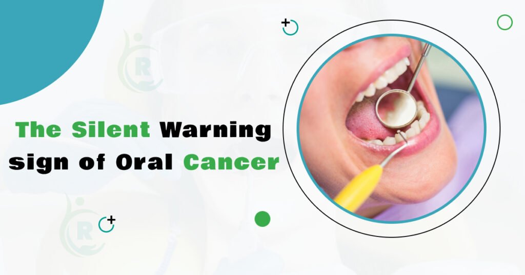 Oral Cancer Treatment in Bikaner