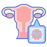 Ovarian Cancer Treatment in Bikaner