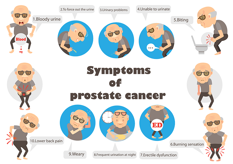 Symptoms of Prostate Cancer