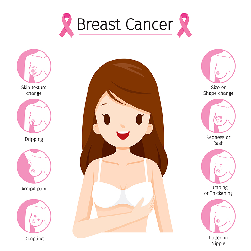 Symptoms of Breast Cancer