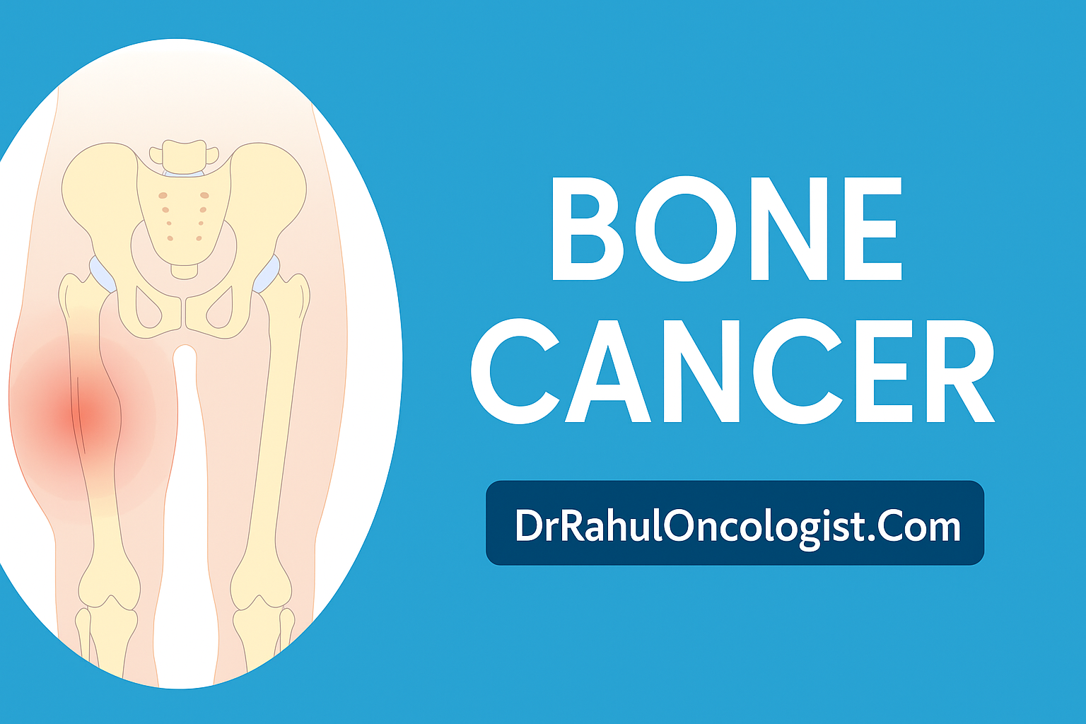 Bone Cancer Treatment in Bikaner