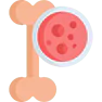 Bone Cancer Treatment in Bikaner